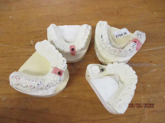 Dental Molds Image 1++